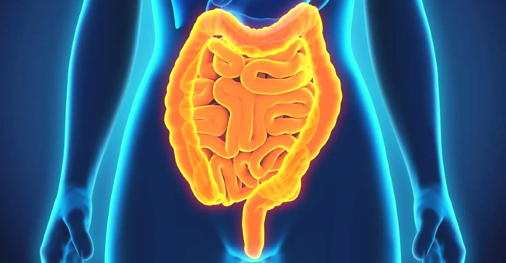Ileus.jpg